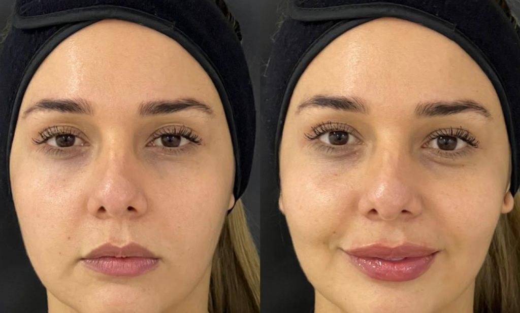 Blog-Equal-labios