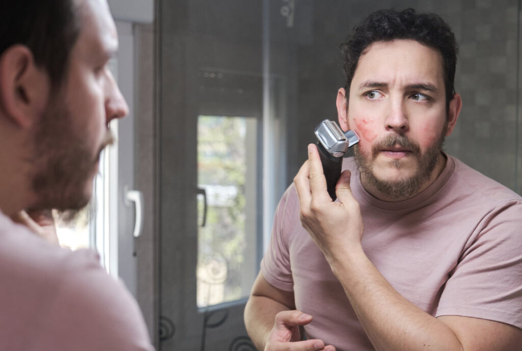 Depilación láser para hombres en Equal Salud y Belleza