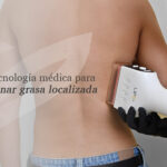 Lipo1060: La tecnología médica para eliminar grasa localizada sin cirugía 
